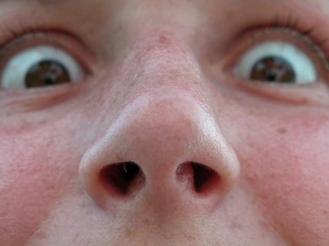 fotka